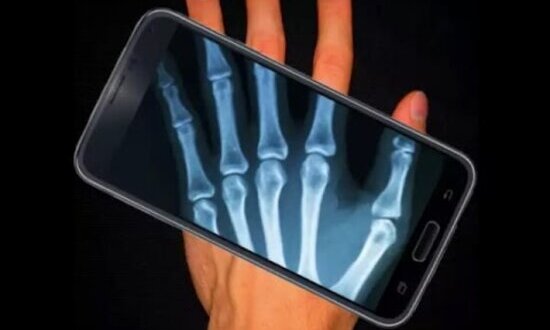 Applications that Unlock the X-ray Function on Cell Phones