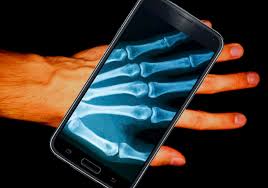 Applications that allow you to unlock the X-ray function on your cell phone